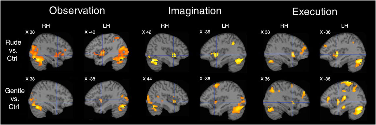 Brain scan